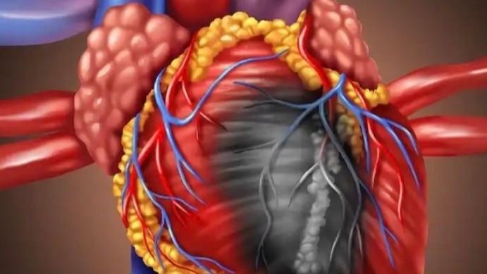  数万案例复盘：从心源性猝死机制透视预防逻辑 新闻 数万案例复盘：从心源性猝死机制透视预防逻辑 新闻 数万案例复盘：从心源性猝死机制透视预防逻辑 新闻